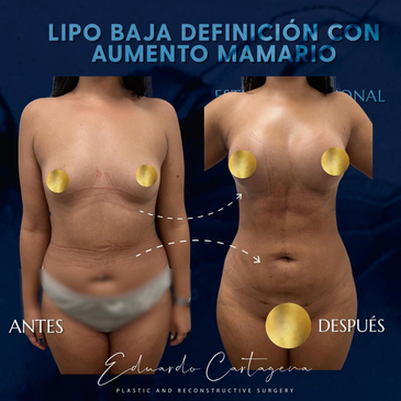 Slider image (9) Dr. Eduardo Cartagena - Plastic Surgeon in Mexico City